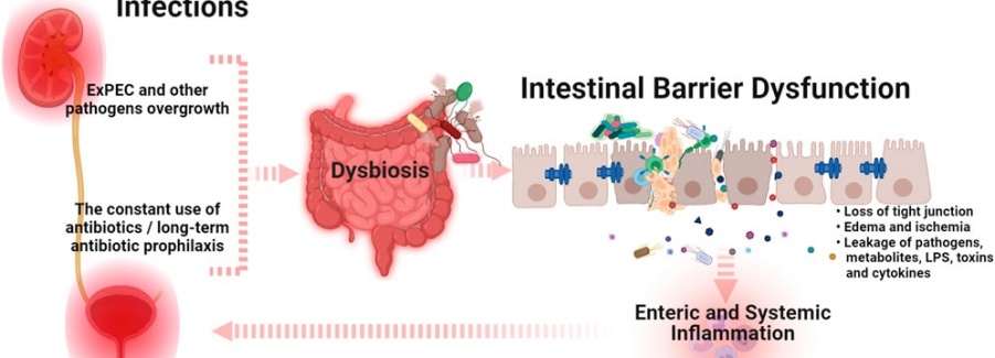 Urinary Tract Infection (UTI) Program 